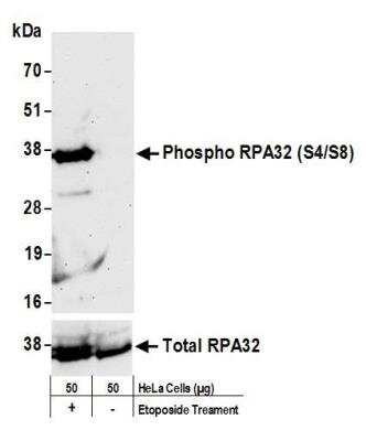 rpa2 p ser4 p ser8 antibody nbp1